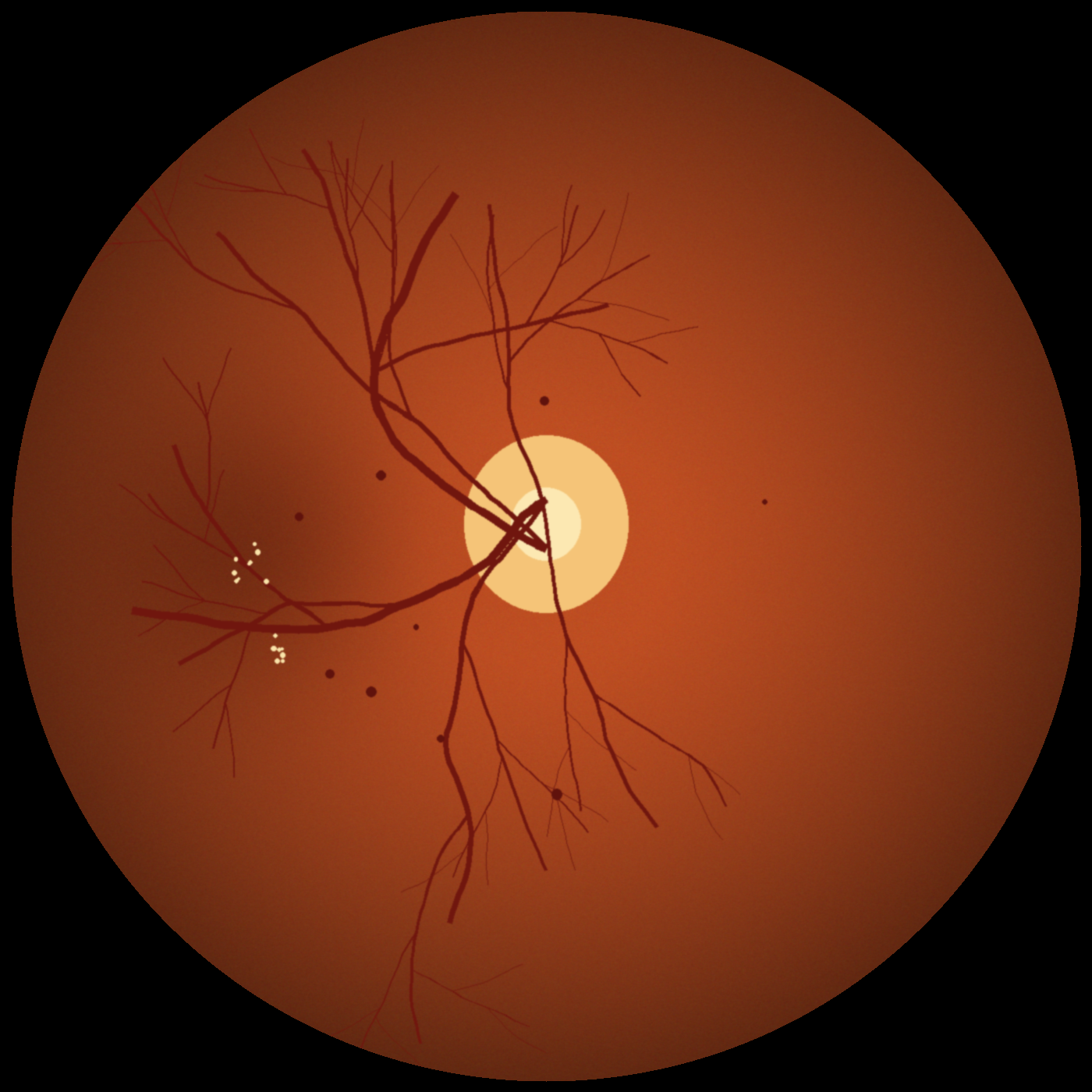 DR image, OD