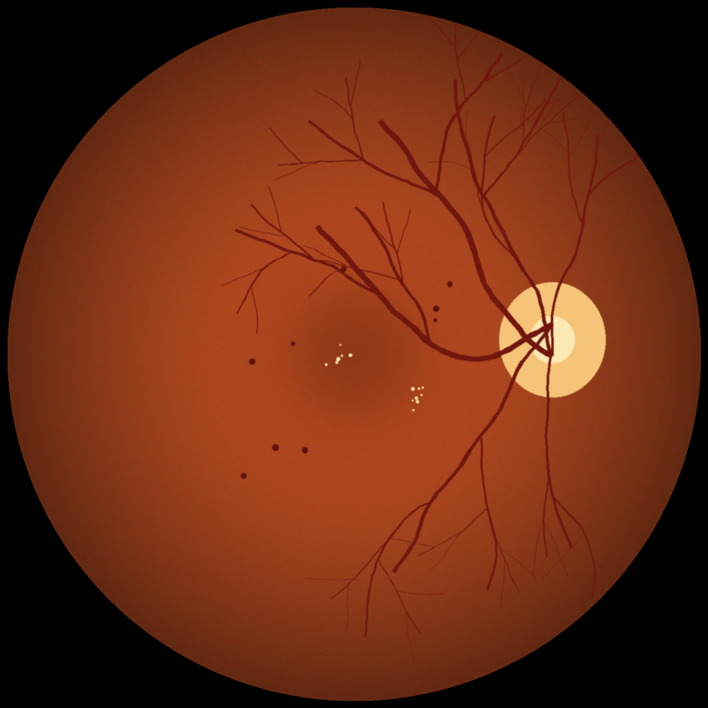 DR image, OD