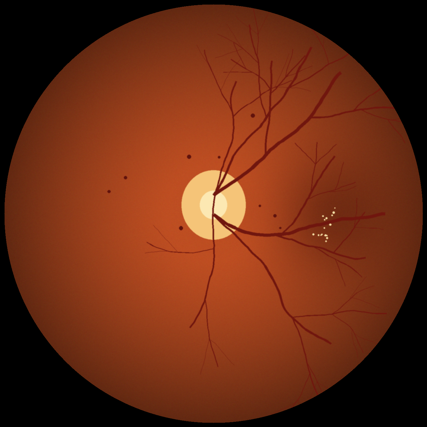DR image, OS