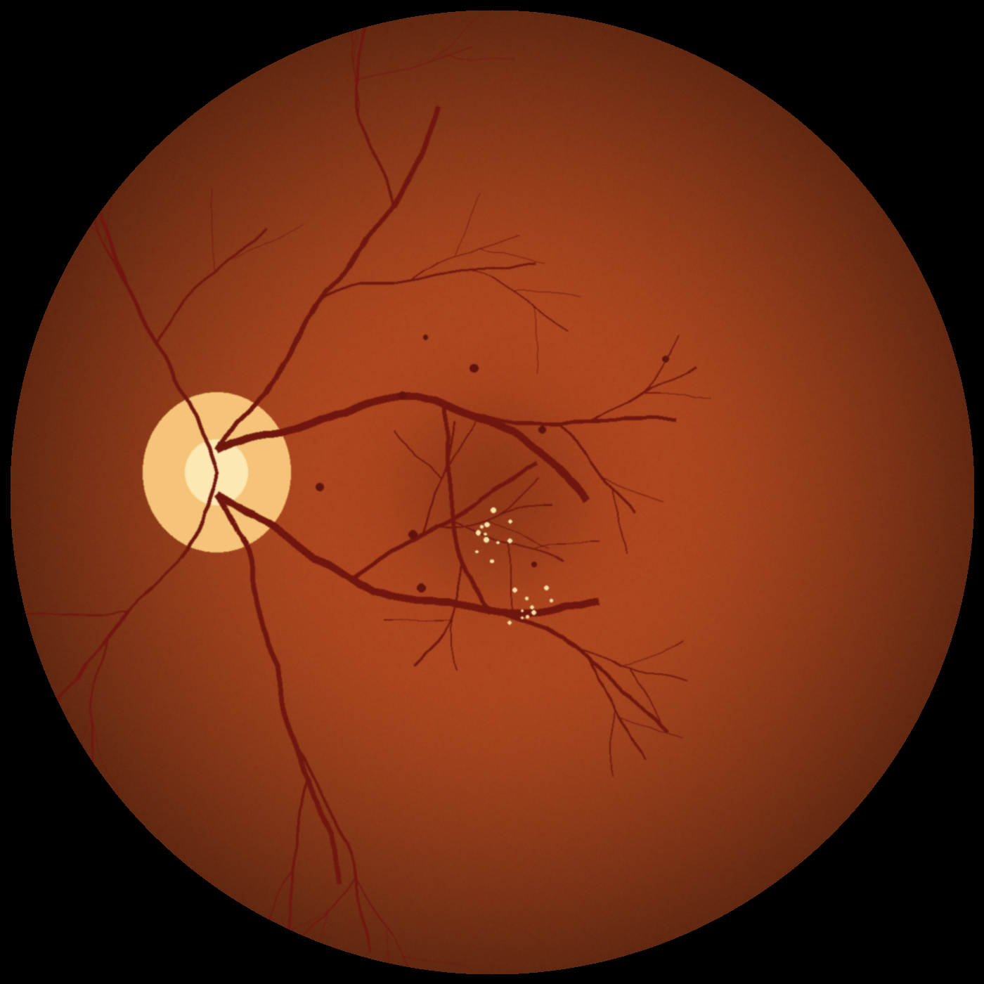 DR image, OS
